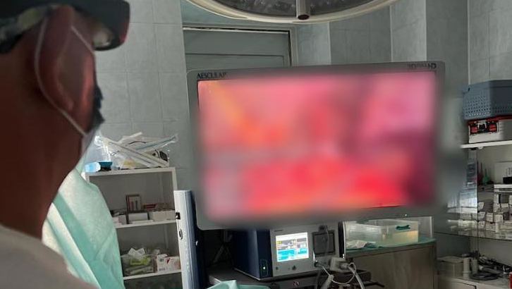 Прикарпатські хірурги вперше прооперували жінку з пухлиною Франца